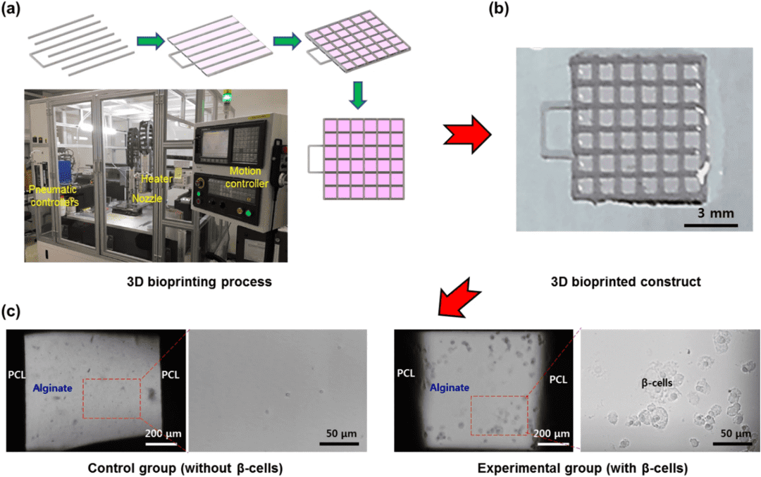 生物打印開發(fā)含有產(chǎn)生胰島素的β細(xì)胞的3D皮下植入物